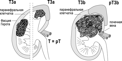 Схематическое изображение стадий